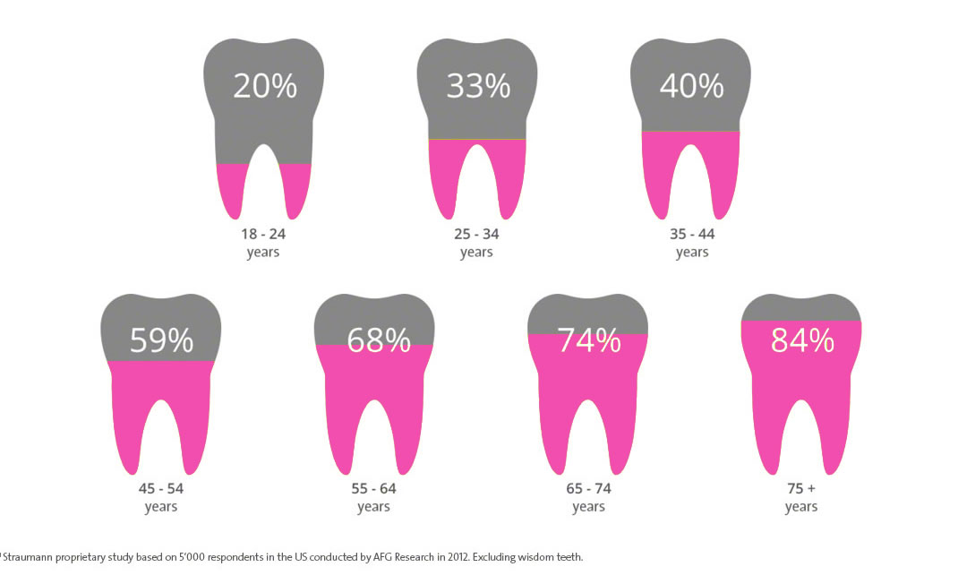 Dental Implants Info