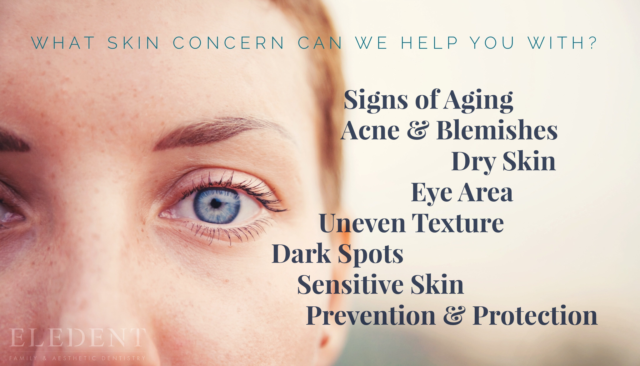 Signs of Ageing